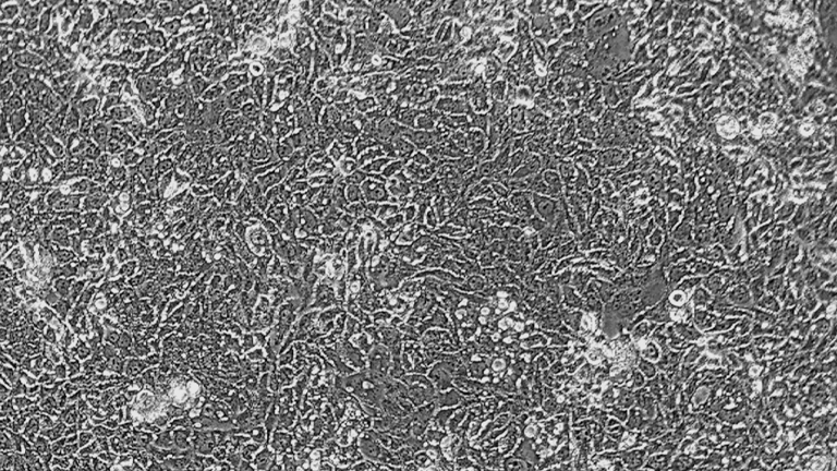Calu-3人肺腺癌細(xì)胞（STR鑒定正確）