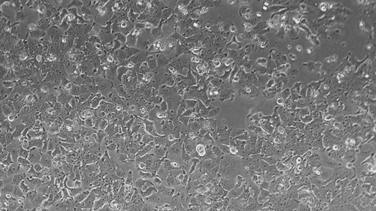NCI-H2170人肺鱗癌細(xì)胞（STR鑒定正確）