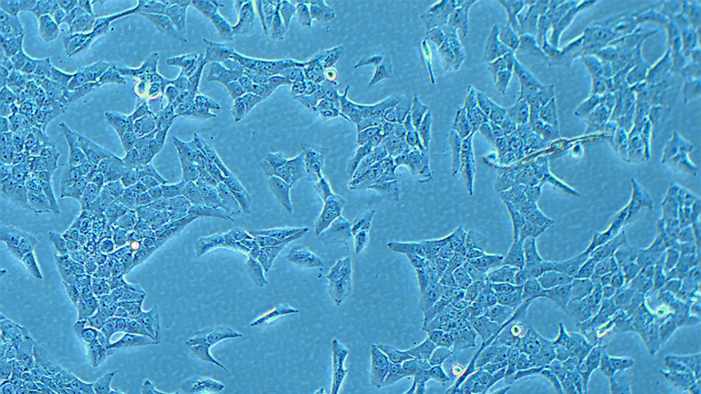 NCI-H2228人非小細(xì)胞肺癌細(xì)胞（STR鑒定正確）