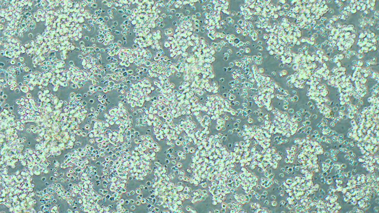 NCI-H146人小細(xì)胞肺癌細(xì)胞（骨髓轉(zhuǎn)移）（STR鑒定正確）