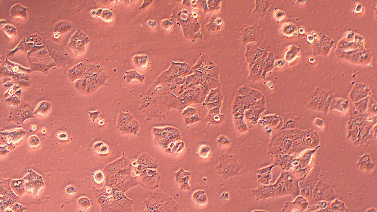 ZR-75-30人乳腺導(dǎo)管癌細胞（STR鑒定正確）