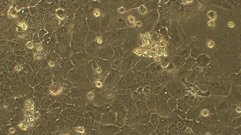 Caov-3人卵巢癌細(xì)胞（STR鑒定正確）