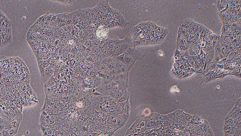 JEG-3人絨毛膜癌細(xì)胞（STR鑒定正確）