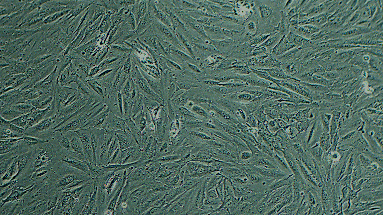 A498人腎癌細(xì)胞（STR鑒定正確）