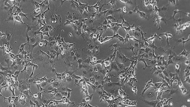 COS-1非洲綠猴腎細(xì)胞（種屬鑒定正確）