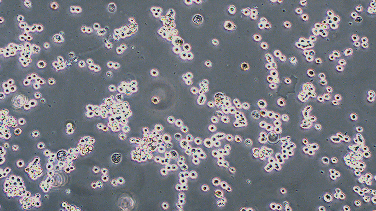 SK-MEL-1人皮膚黑色素瘤細(xì)胞（STR鑒定正確）
