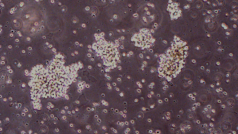 HuT 78人T淋巴細(xì)胞白血病細(xì)胞（STR鑒定正確）