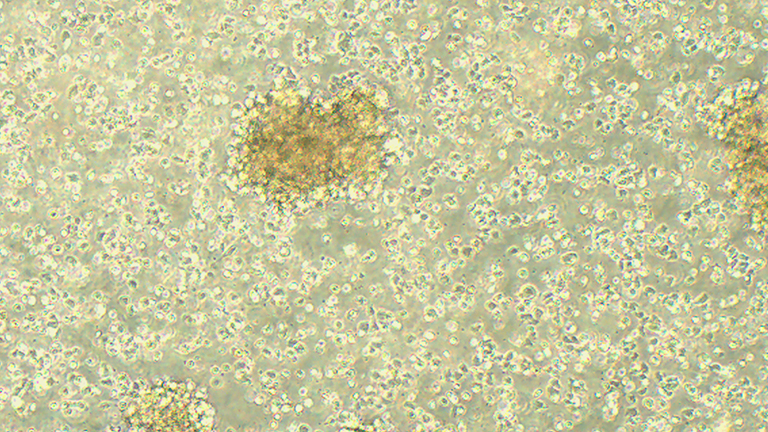 ARH-77人外周血淋巴瘤白血病細(xì)胞（STR鑒定正確）