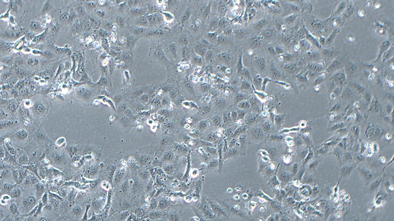 K1人甲狀腺癌細(xì)胞（乳頭狀）（STR鑒定正確）
