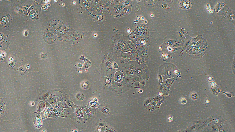 SW1990人胰腺癌細胞（二級腺癌）（STR鑒定正確）