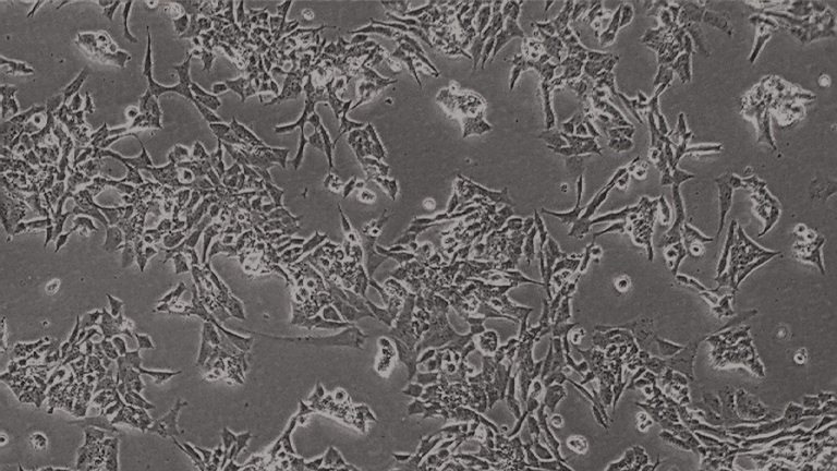SK-N-MC人神經(jīng)上皮瘤細(xì)胞（STR鑒定正確）