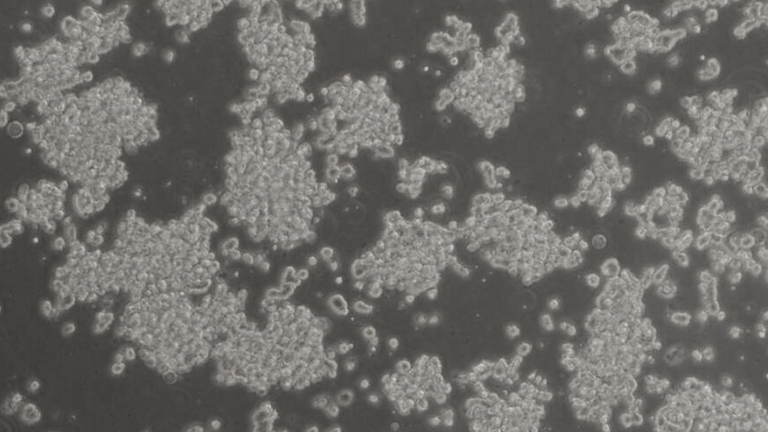 SK-NEP-1人尤因肉瘤細(xì)胞（STR鑒定正確）