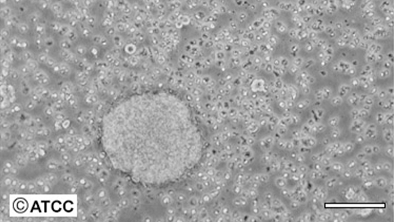 AtT-20小鼠垂體瘤細胞（STR鑒定正確）