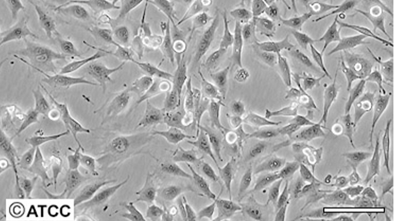 MDA-MB-435s人乳腺癌細胞（STR鑒定正確）