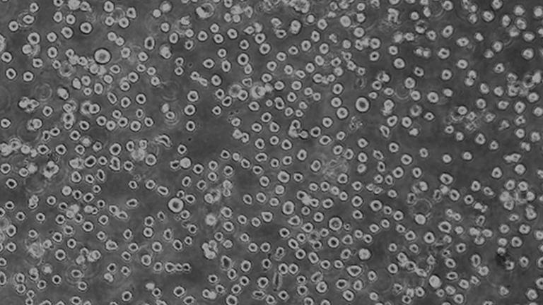 TF-1人血液白血病細(xì)胞（STR鑒定正確）