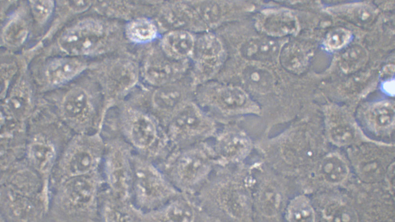 SACC-LM人涎腺腺樣囊性癌細(xì)胞（STR鑒定正確）