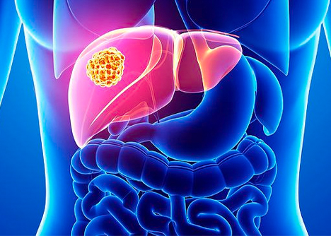 細胞學堂|人肝癌細胞系