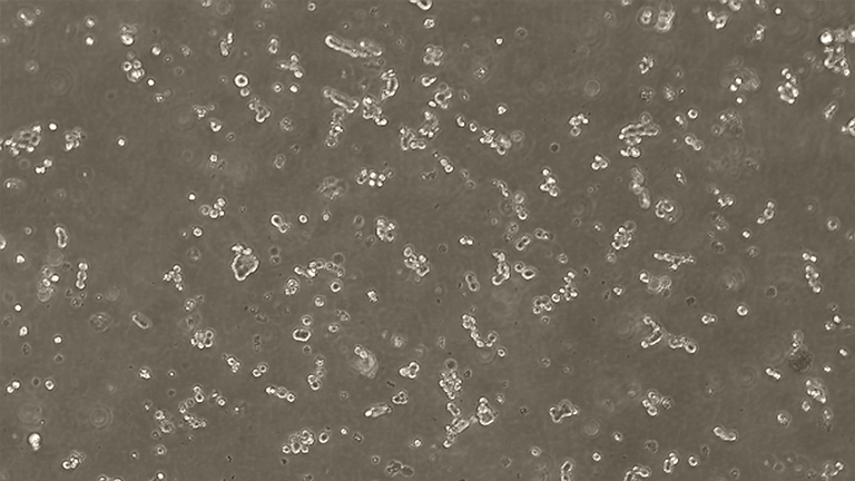 NCI-H82人小細(xì)胞肺癌細(xì)胞（STR鑒定正確）