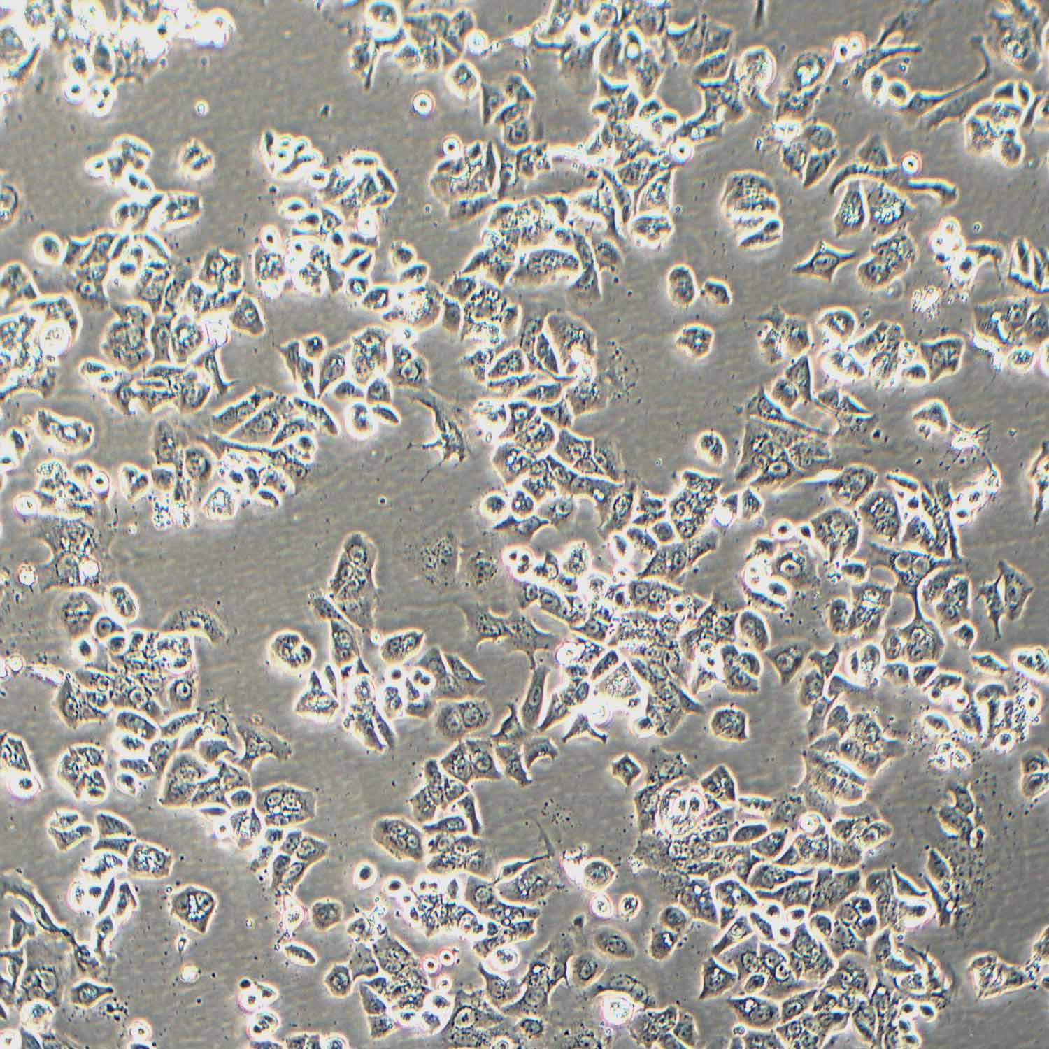 SK-BR-3-LUC示蹤穩(wěn)定細(xì)胞株（STR鑒定正確）