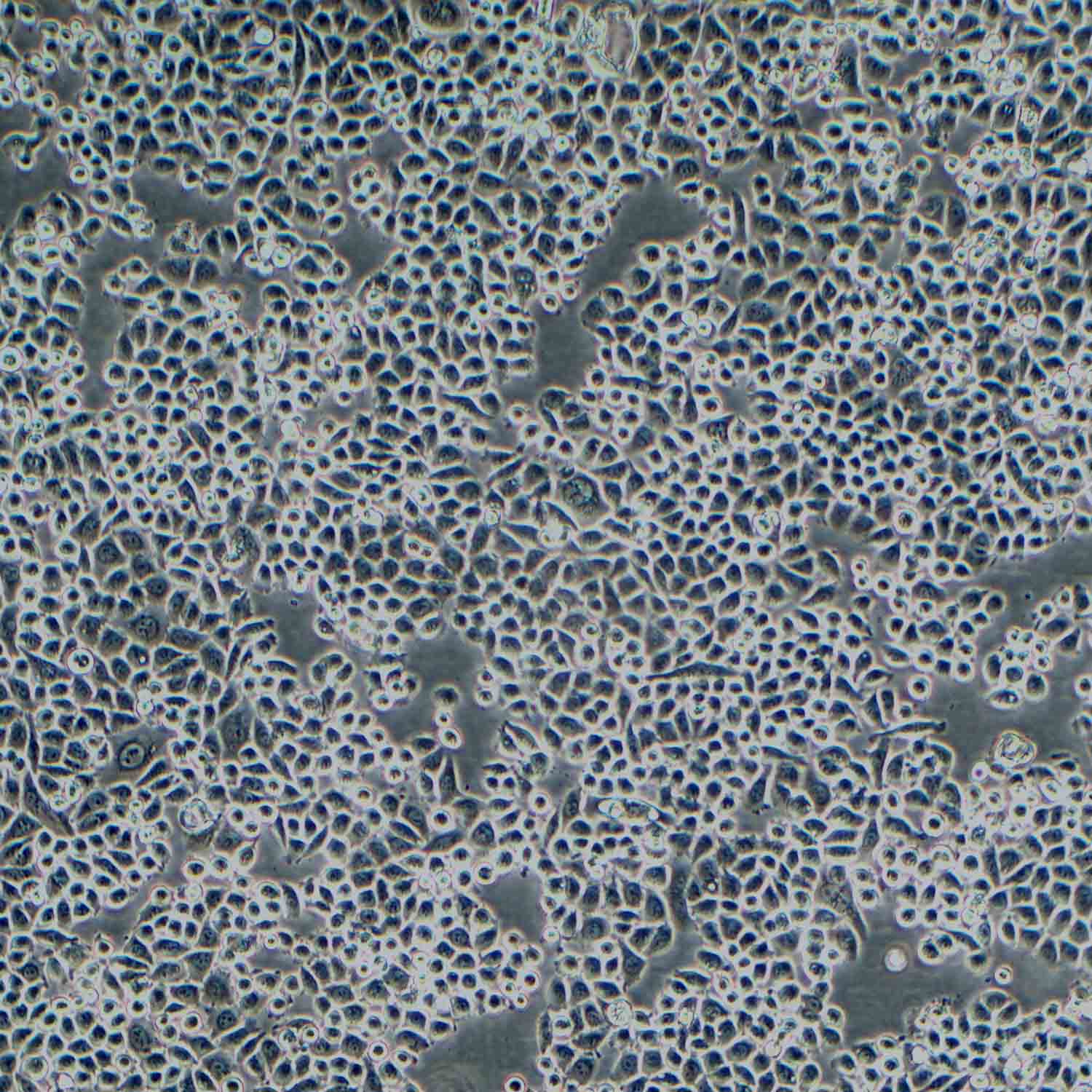 PC9/DDP-LUC人非小細(xì)胞肺癌細(xì)胞順鉑耐藥株示蹤穩(wěn)定株（STR鑒定正確）