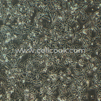 MB49 ??膀胱癌細(xì)胞（STR鑒定正確）