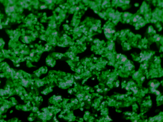Hep G2-NTCP-GFP 過表達NTCP基因的帶GFP熒光的人肝癌細胞株（STR鑒定正確）