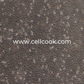 SCC-25人舌鱗癌細胞（STR鑒定正確）