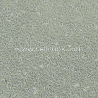 U-2 OS人骨肉瘤細(xì)胞（STR鑒定正確）