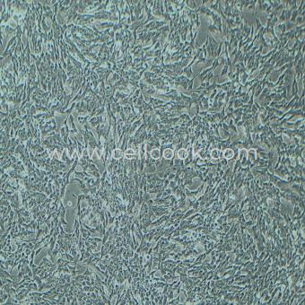 SH-SY5Y人神經(jīng)母細(xì)胞瘤細(xì)胞（STR鑒定正確）