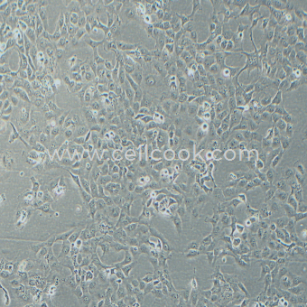 B-CPAP人甲狀腺癌細(xì)胞（乳頭狀）（STR鑒定正確）