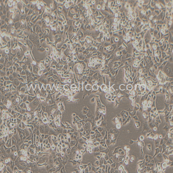 Panc-1人胰腺癌細(xì)胞（未分化）（STR鑒定正確）