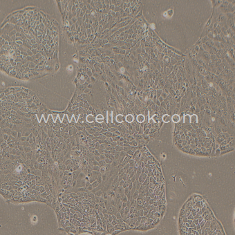 Capan-2人胰腺癌細胞（高分化）（STR鑒定正確）