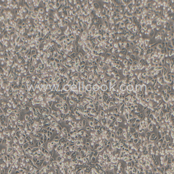 AsPC-1人轉移胰腺腺癌細胞(中等至未分化)（STR鑒定正確）