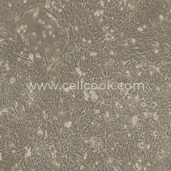 CFPAC-1人胰腺癌細胞（STR鑒定正確）