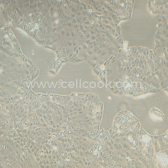 HPAF-II人胰腺癌細胞（STR鑒定正確）