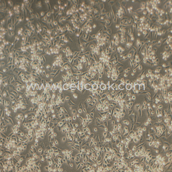 MIA PaCa-2人胰腺癌細胞（STR鑒定正確）