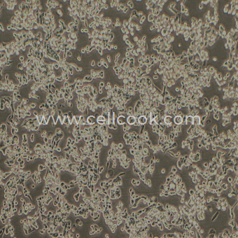 SUIT-2人胰腺癌細胞（STR鑒定正確）