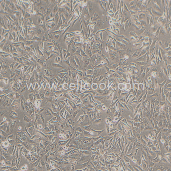 NCI-H28人間皮瘤細胞（STR鑒定正確）