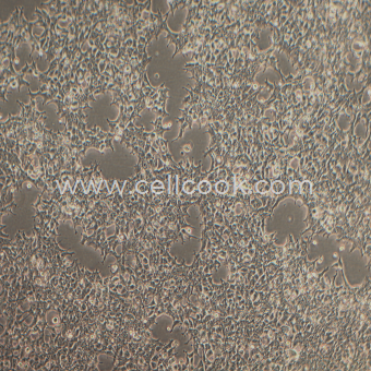 HEK-293人胚腎細(xì)胞（STR鑒定正確）