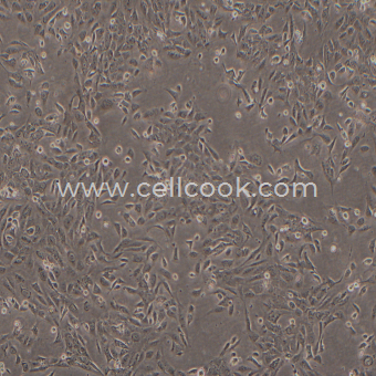 SV-HUC-1人膀胱上皮永生化細(xì)胞（STR鑒定正確）