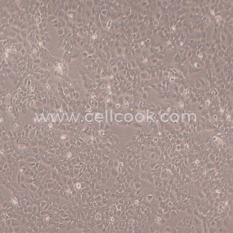 HaCaT人永生化角質(zhì)形成細(xì)胞（STR鑒定正確）