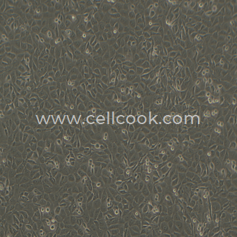 HCE-T人角膜上皮細(xì)胞（STR鑒定正確）