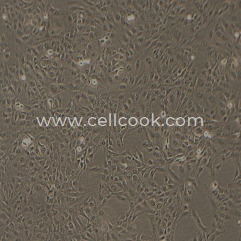 LX-2人肝星狀細(xì)胞（STR鑒定正確）