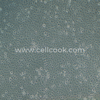 HTR-8/Svneo 人永生化滋養(yǎng)層細胞（STR鑒定正確）