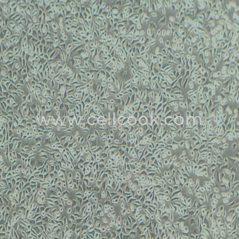 L929小鼠成纖維細(xì)胞（STR鑒定正確）