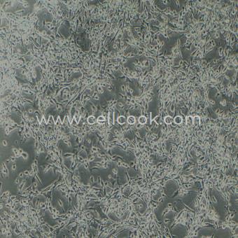 MFC小鼠前胃癌細胞（種屬鑒定正確）