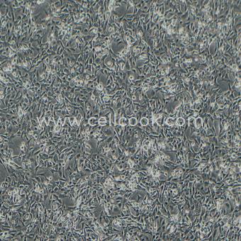 SV40 MES 13小鼠腎小球系膜細胞（種屬鑒定正確）