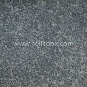 Beta-TC-6小鼠胰島素瘤胰島β細胞（種屬鑒定正確）