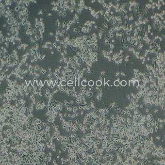 RAG小鼠腎腺癌細胞（種屬鑒定正確）