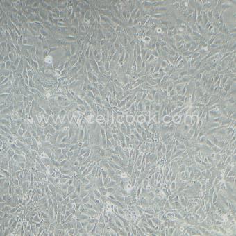 3T3-L1小鼠胚胎成纖維細胞（STR鑒定正確）